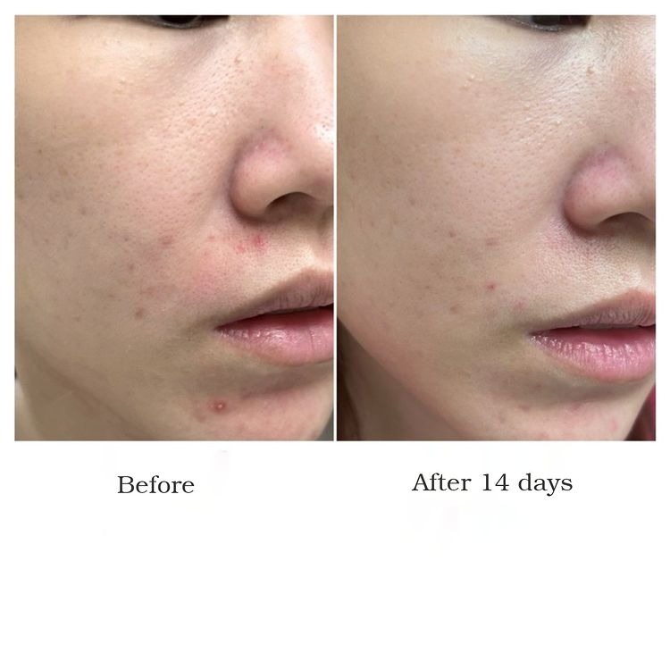 Tinh Chất Bioderma Sensibio Defensive Serum 30ml