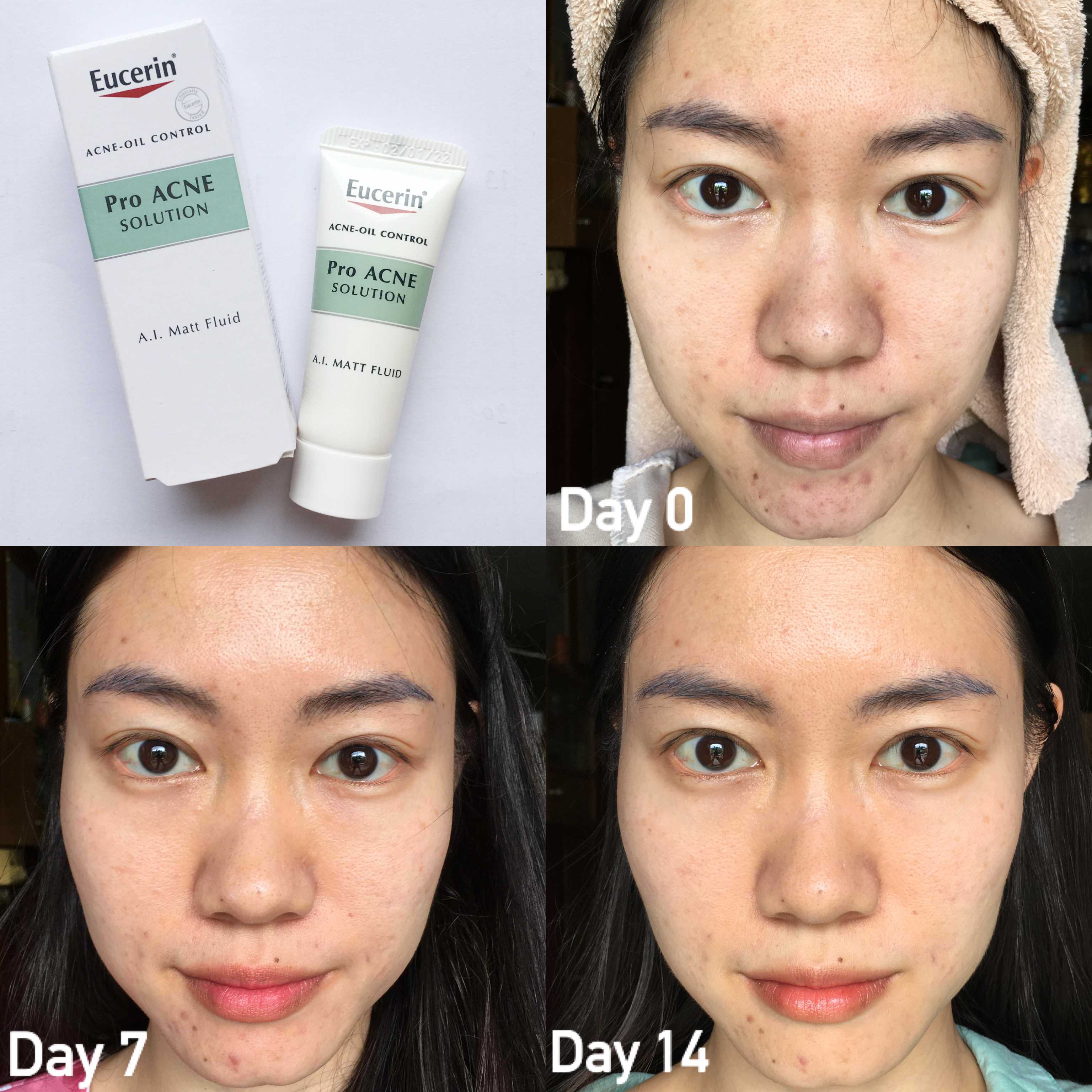 Kem Dưỡng Eucerin Pro Acne Solution A.I. Matt Fluid 50ml