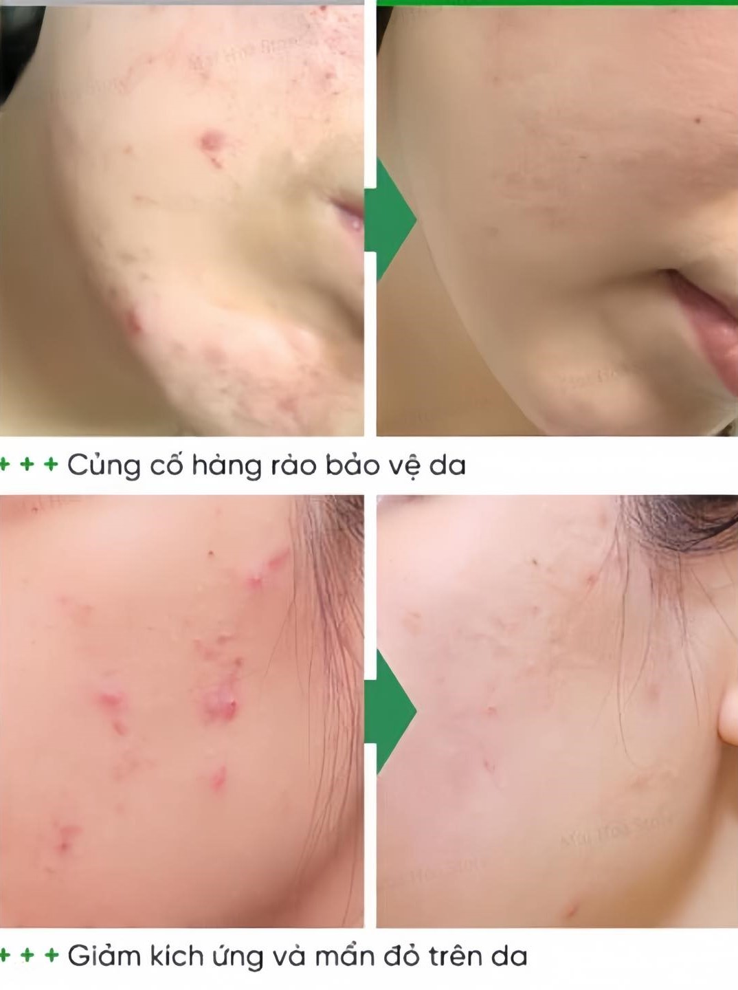 Kem Dưỡng Numbuzin No1 Pantothenic B5 Active Smoothing Cream 80ml