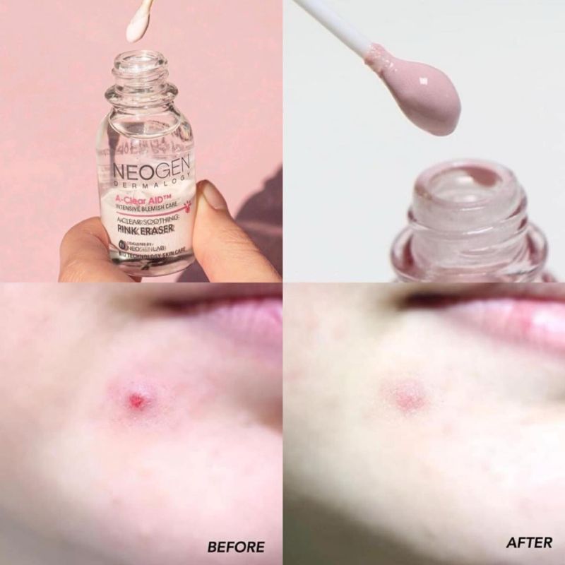 Chấm Mụn 2 Lớp Neogen A-Clear Soothing Pink Eraser 15ml