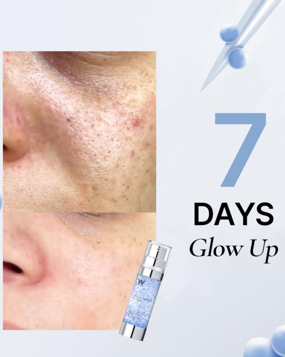 Tinh Chất Vi Kim Wonjin Spicule Capsule Teca Serum 30ml