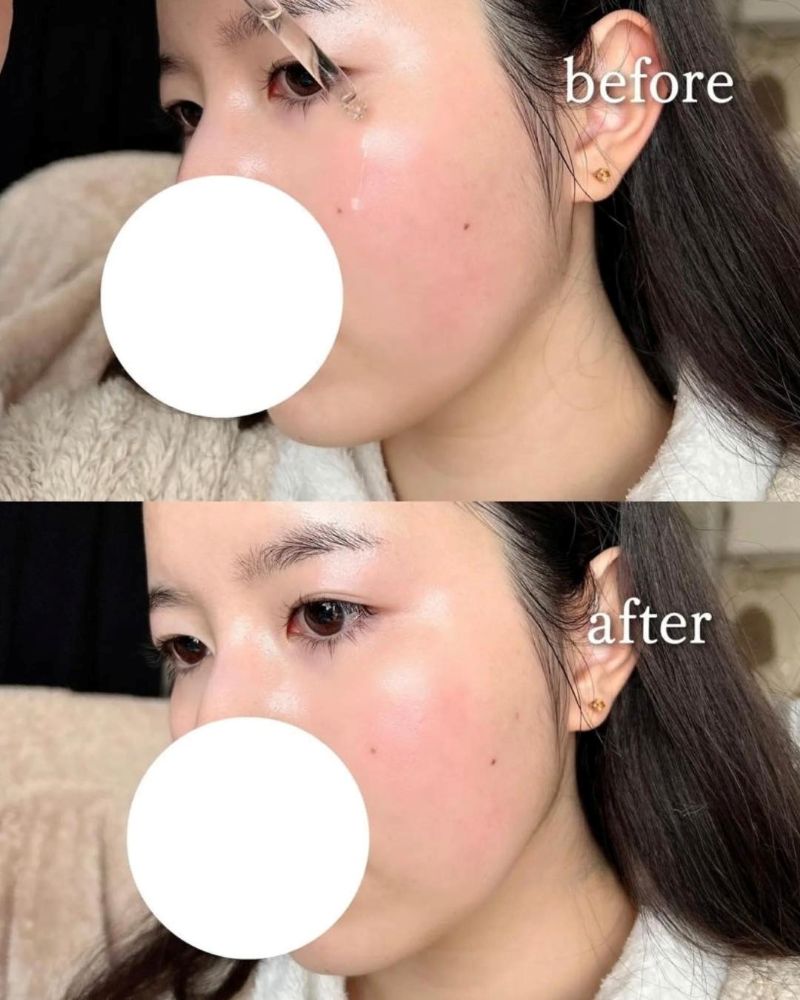 Tinh Chất CNP Laboratory Propolis Rescue Ampule 50ml