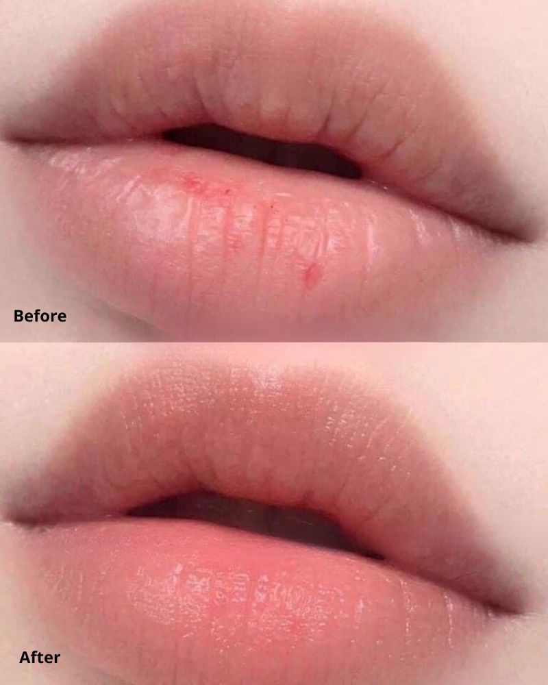 Dưỡng Môi Belif Super Knights Multi Vitamin Lipcerin 15ml