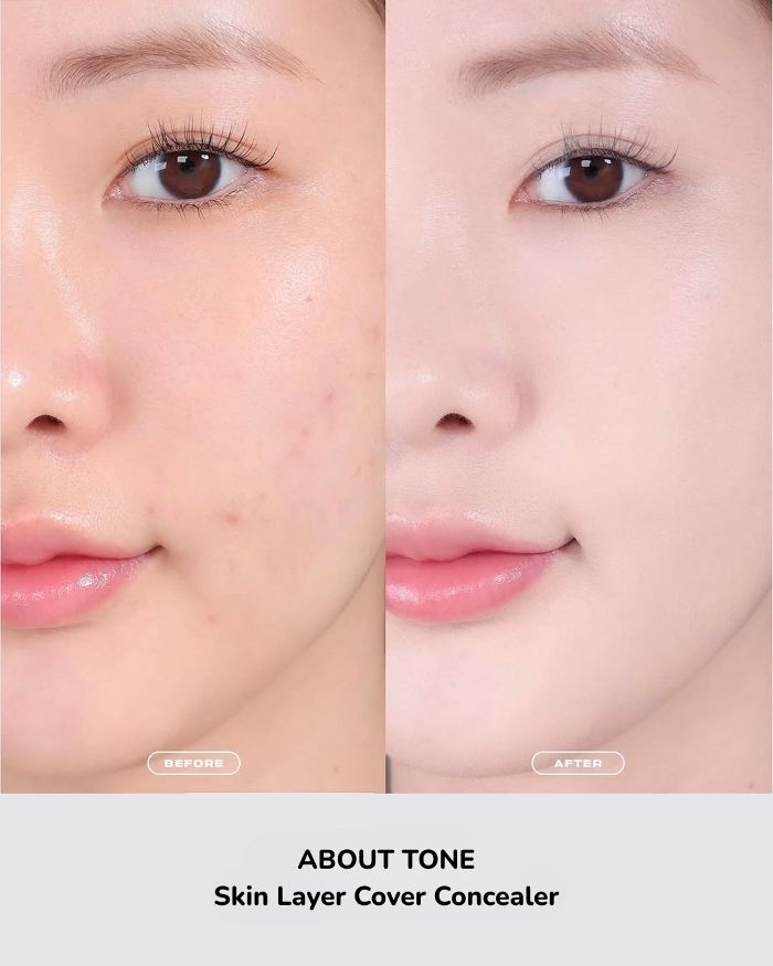Che Khuyết Điểm About Tone Skin Layer Cover Concealer 5.6g