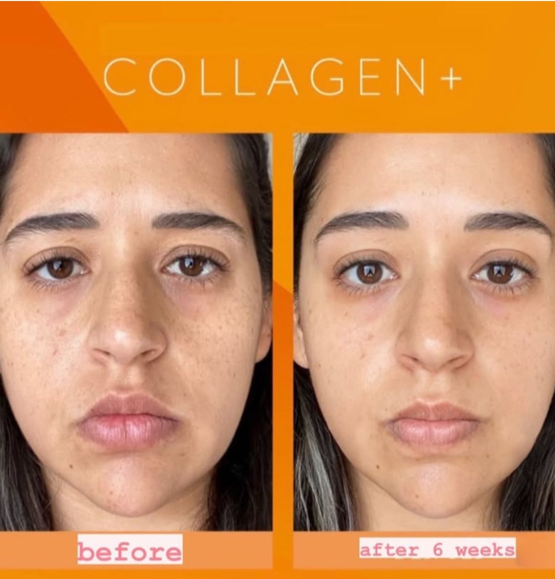 Thực Phẩm Bổ Sung Collagen Nội Sinh Menard Collagen Gold (10×30ml)