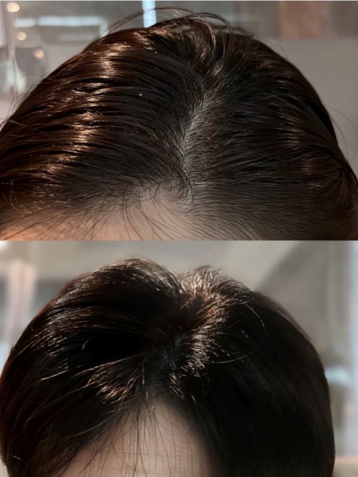 Bộ Gội Xả Muối Biển Spes Sea Salt Hyaluronic Acid Hydrating 600ml