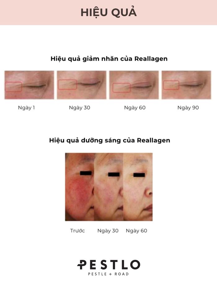 Mặt Nạ Lột Trẻ Hoá Da Pestlo Baby Collagen Glow Mask 70ml