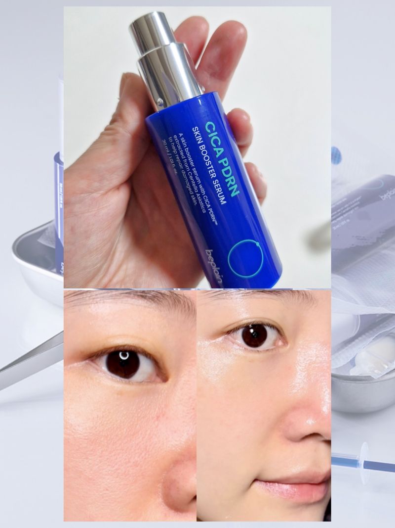 Tinh Chất Beplain Cica PDRN Skin Booster Serum 30ml
