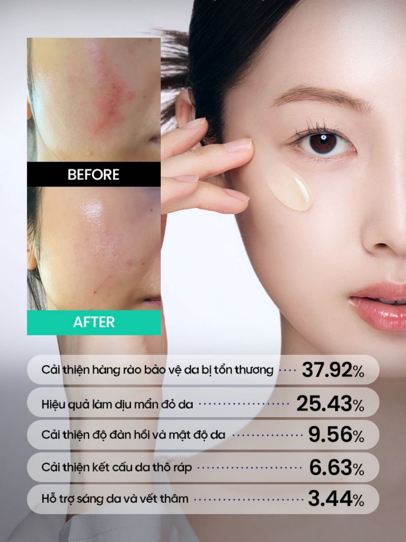 Tinh Chất Beplain Cica PDRN Skin Booster Serum 30ml
