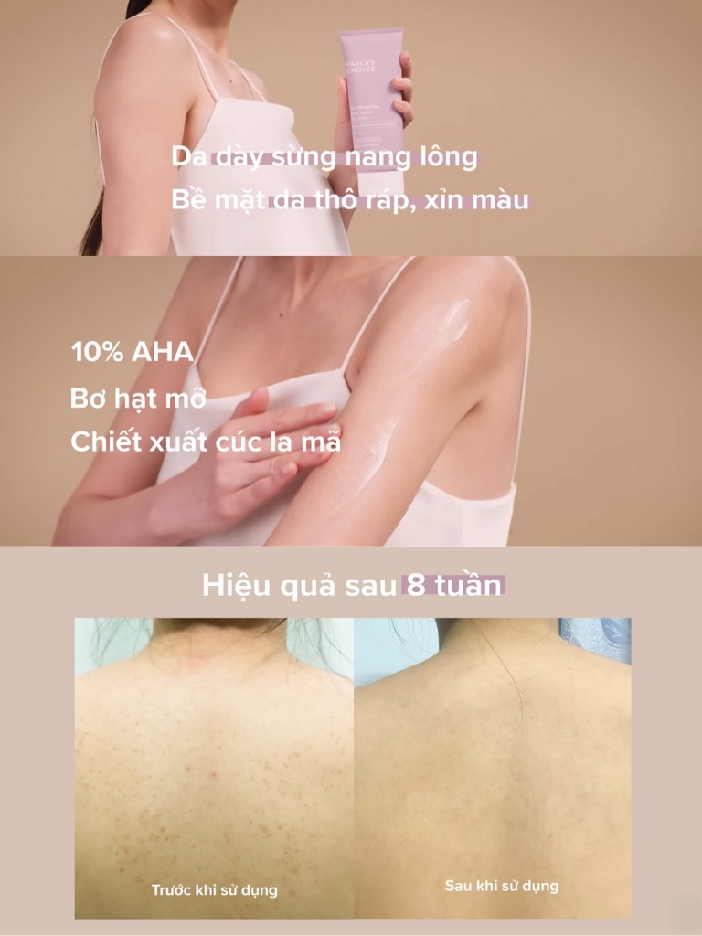 Dưỡng Thể Paula's Choice Resist Skin Revealing Body Lotion 10% AHA 210ml