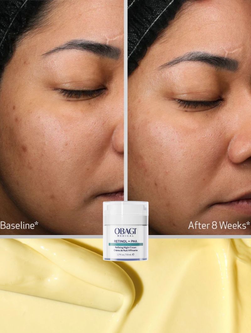 Kem Dưỡng Tái Tạo Obagi Retinol+PHA Refining Night Cream 50ml