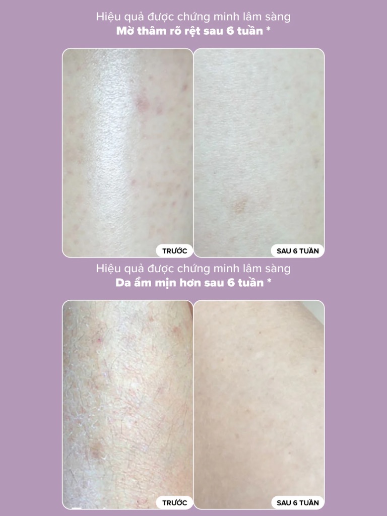 Dưỡng Thể Paula's Choice Resist Skin Revealing Body Lotion 10% AHA 210ml