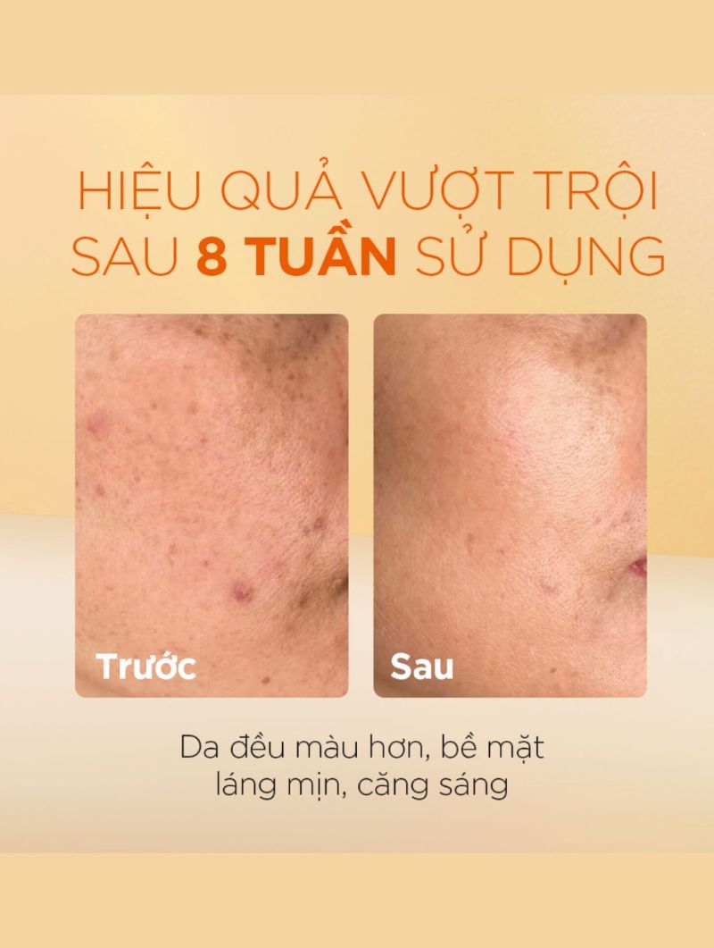Tinh Chất Oh!Oh! Daily Nia23 Advanced Correcting Serum 50ml