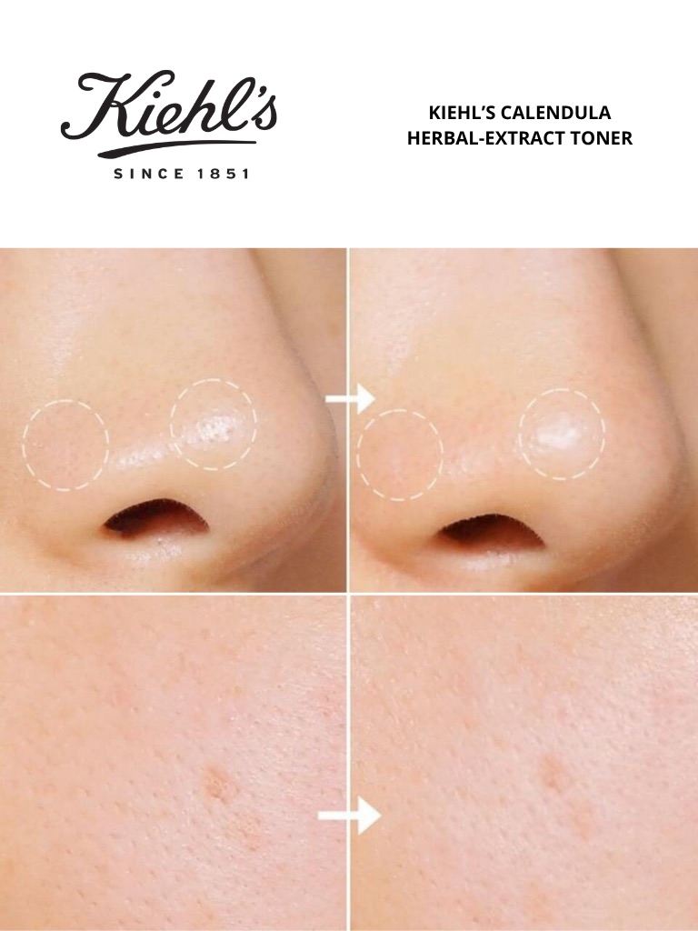 Bộ Đôi Hoa Cúc Làm Sạch Và Làm Dịu Da Kiehl’s Calendula Toner 250ml + Foaming Face Wash 230ml