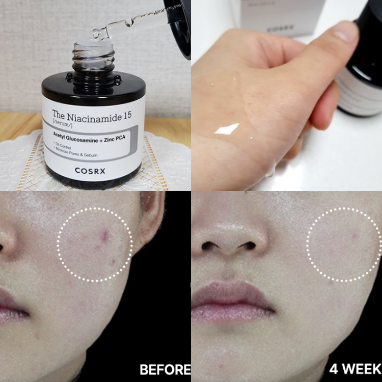 Tinh Chất Cosrx The Niacinamide 15 Serum 20ml