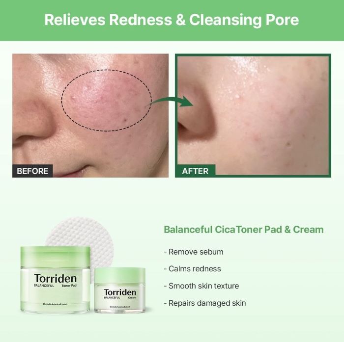 Kem Dưỡng Torriden Balanceful Centella Asiatica Extract Cream 80ml