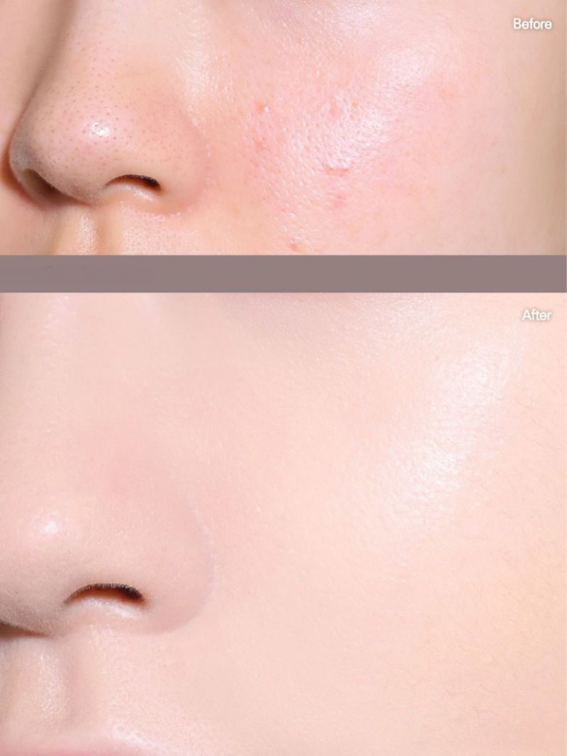 Phấn Nước Mịn Lì, Che Phủ Cao Clio Kill Cover Founwear Cushion