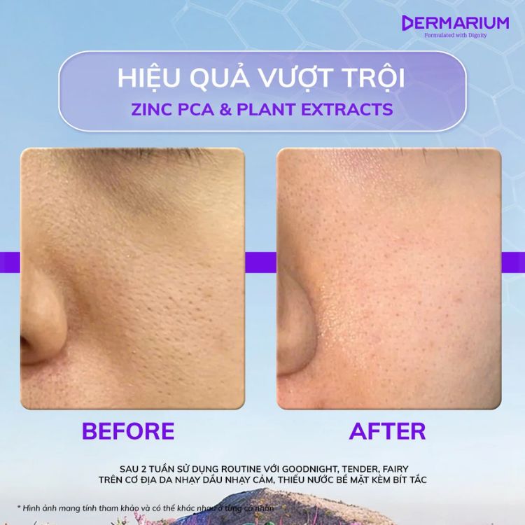 Nước Cân Bằng Cho Da Dầu Mụn Dermarium Fairy Water Toner