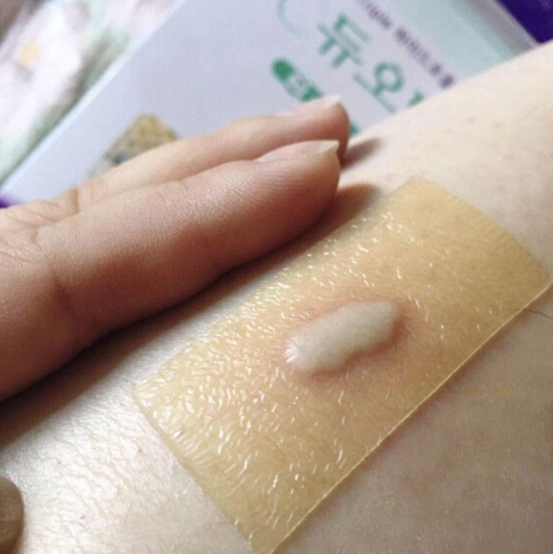 Miếng Dán Vết Thương, Mụn Duoderm Extra Thin 5x10cm
