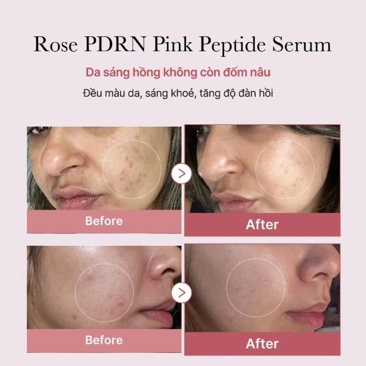 Tinh Chất Hồng Dưỡng Sáng, Săn Chắc Da Medicube PDRN Pink Peptide Serum 30ml