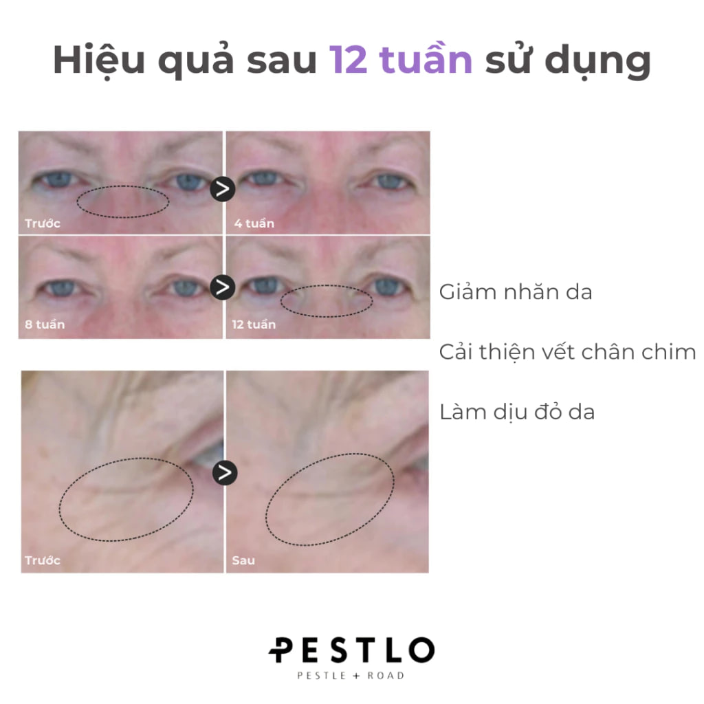 Kem dưỡng chống lão hoá Pestlo Rejurecipe Baku:DN Cream 30ml