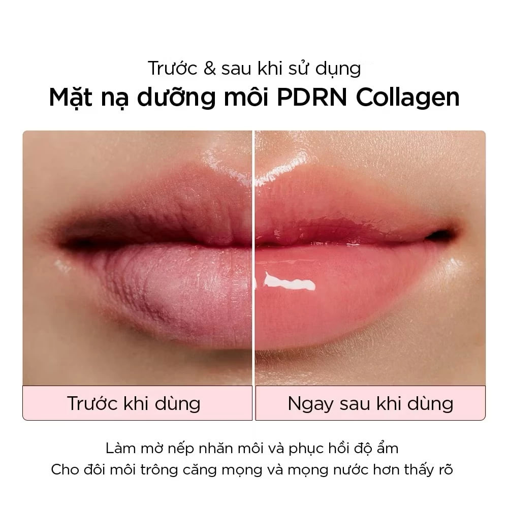 Mặt Nạ Môi Dạng Thạch Abib PDRN Collagen Lip Mask 11g