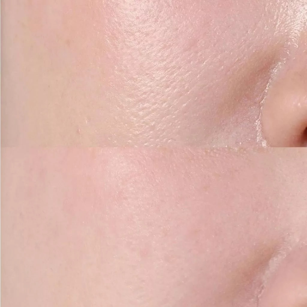 Bộ Sản Phẩm Phấn Nén Espoir Fresh Setting Powder 9g+Setting Fixer 30ml