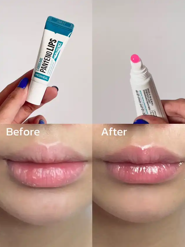 Dưỡng Môi Mediheal Pantenolips 10ml