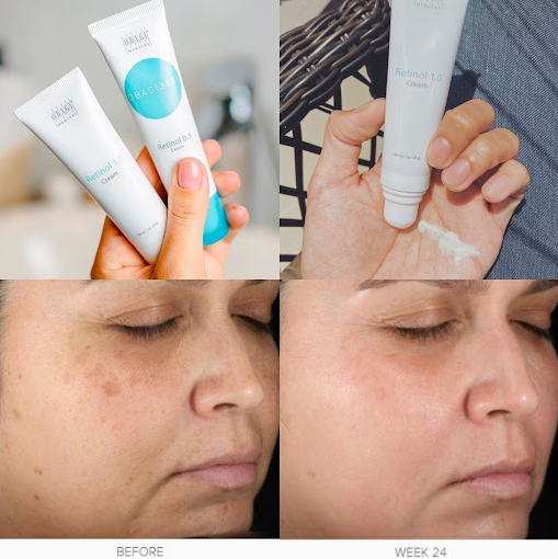 Kem Dưỡng Obagi Retinol 1.0 Cream
