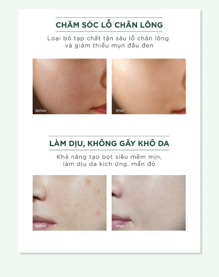Sữa Rửa Mặt Sạch Sâu Caryophy Portulaca Cleansing Foam 150ml