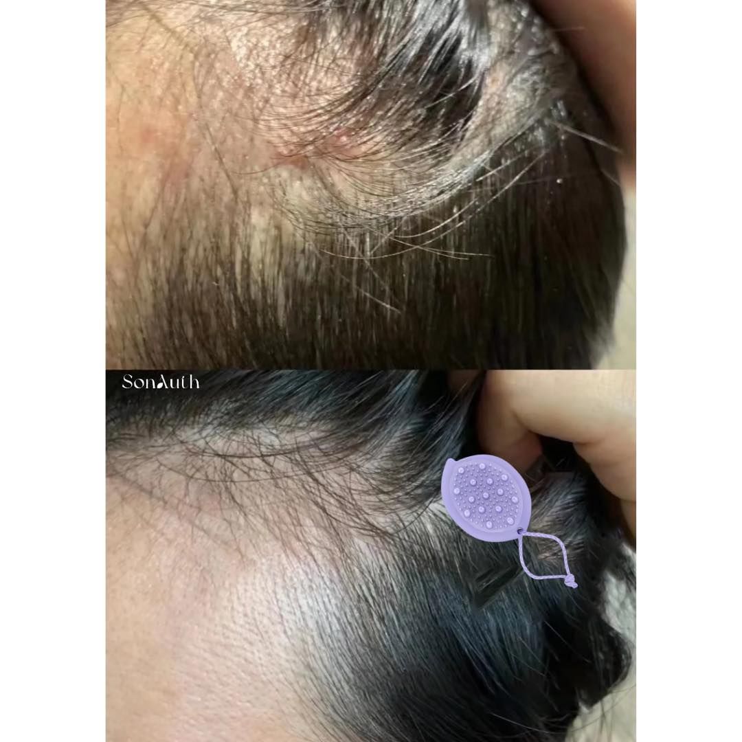 Lược Gội Đầu Wet Brush Go Green Scalp First Exfoliator