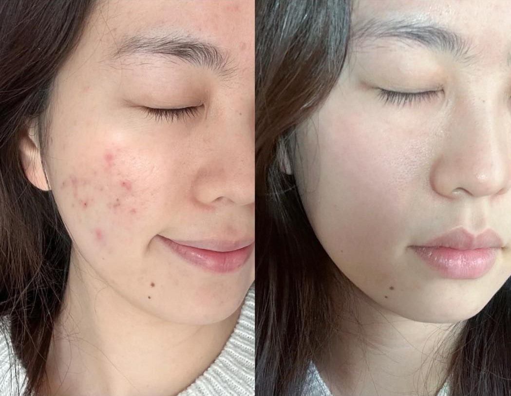 Kem Dưỡng Bioderma Sebium Sensitive 30ml