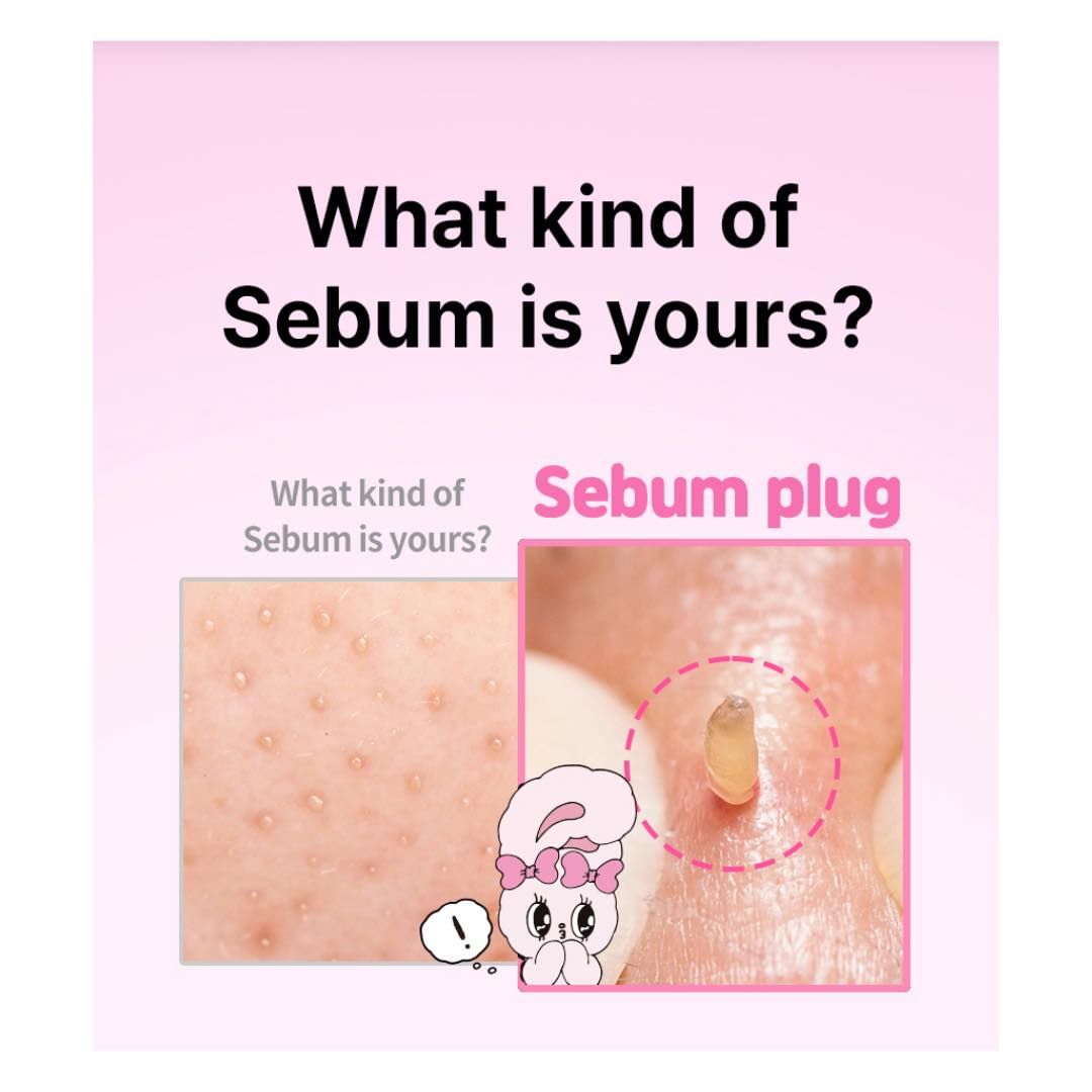 Dung Dịch Làm Mềm Bã Nhờn Ilso Super Melting Sebum Softener 150g