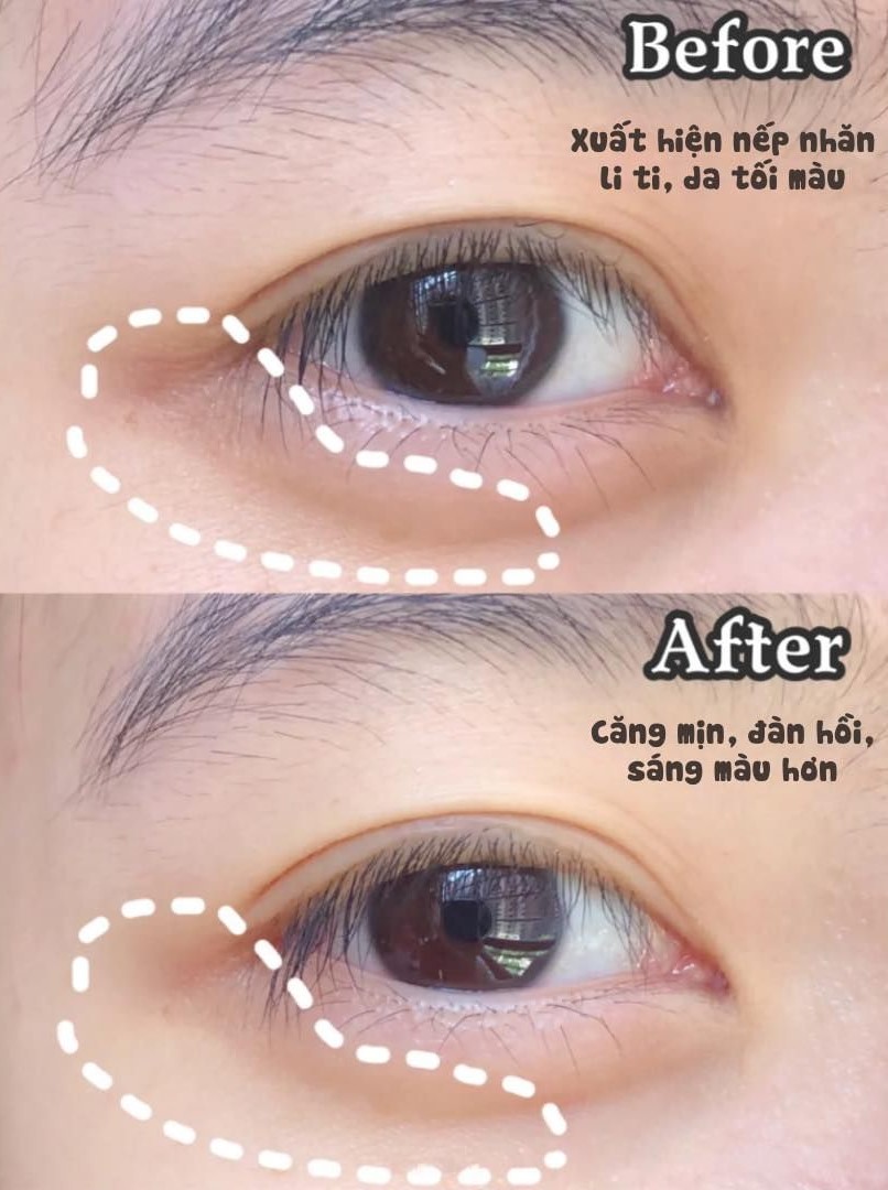 Kem Mắt AHC Age Defense Real Eye Cream