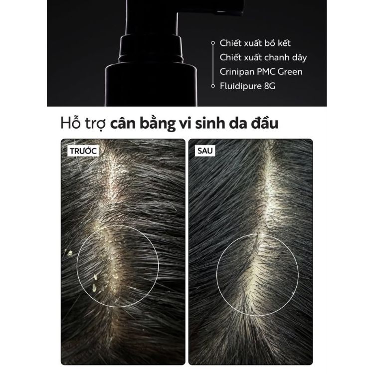 Tẩy Da Chết Da Đầu Bồ Kết Cocoon