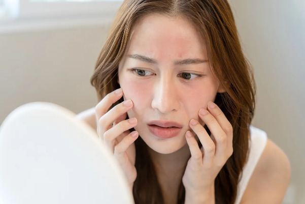 Da nhạy cảm và cách chăm sóc đúng cách để có làn da khỏe mạnh