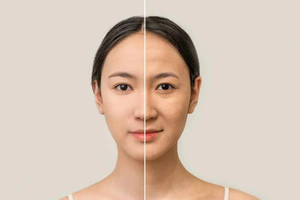 Nên bắt đầu chống lão hoá da từ độ tuổi nào?