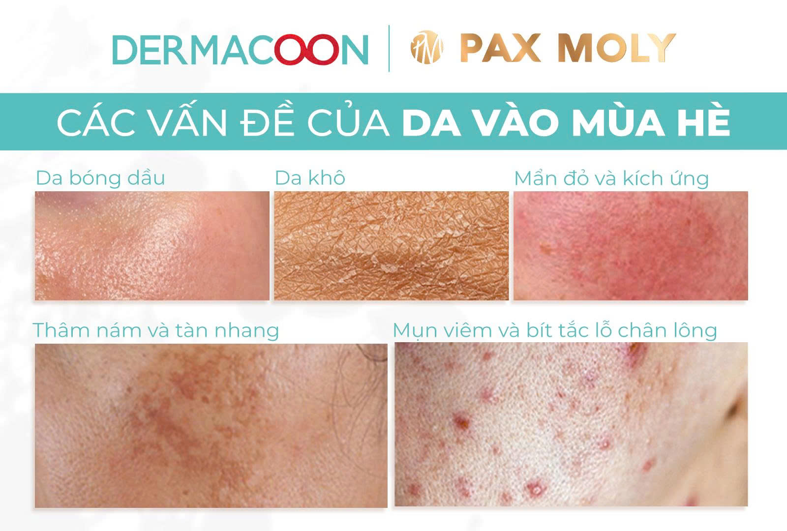 Các vấn đề của da vào mùa hè