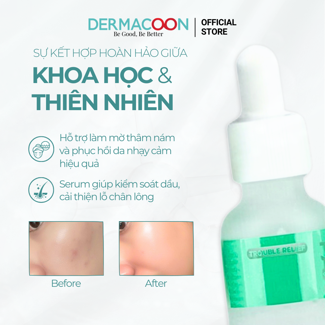 Tinh chất giúp kiểm soát dầu thừa và mờ thâm mụn PAX MOLY Niacinamide 15% + Zinc 5% Serum 30ml