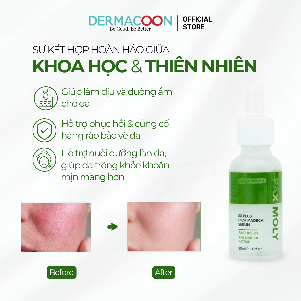 PAXMOLY 5x Plus Cica Madeca Serum 30ml Tinh chất Rau má giúp làm dịu, dưỡng ẩm và hỗ trợ phục hồi da
