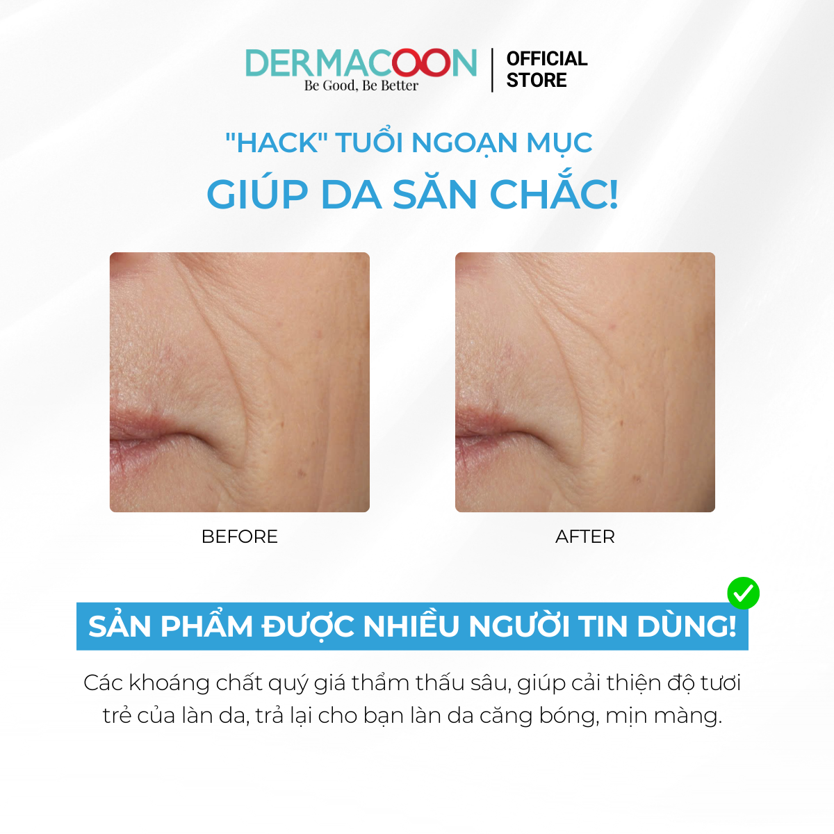 Mặt nạ dưỡng ẩm giúp da mềm mịn căng bóng và tràn đầy sức sống PAXMOLY Super Aqua Mask Pack 5 Miếng