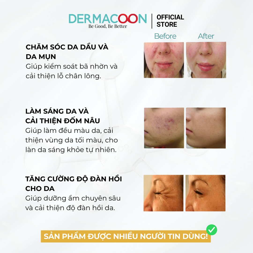 Tinh chất giúp dưỡng sáng và cải thiện độ đàn hồi da PAX MOLY Vitamin C + Collagen 5% AC Serum 50ml