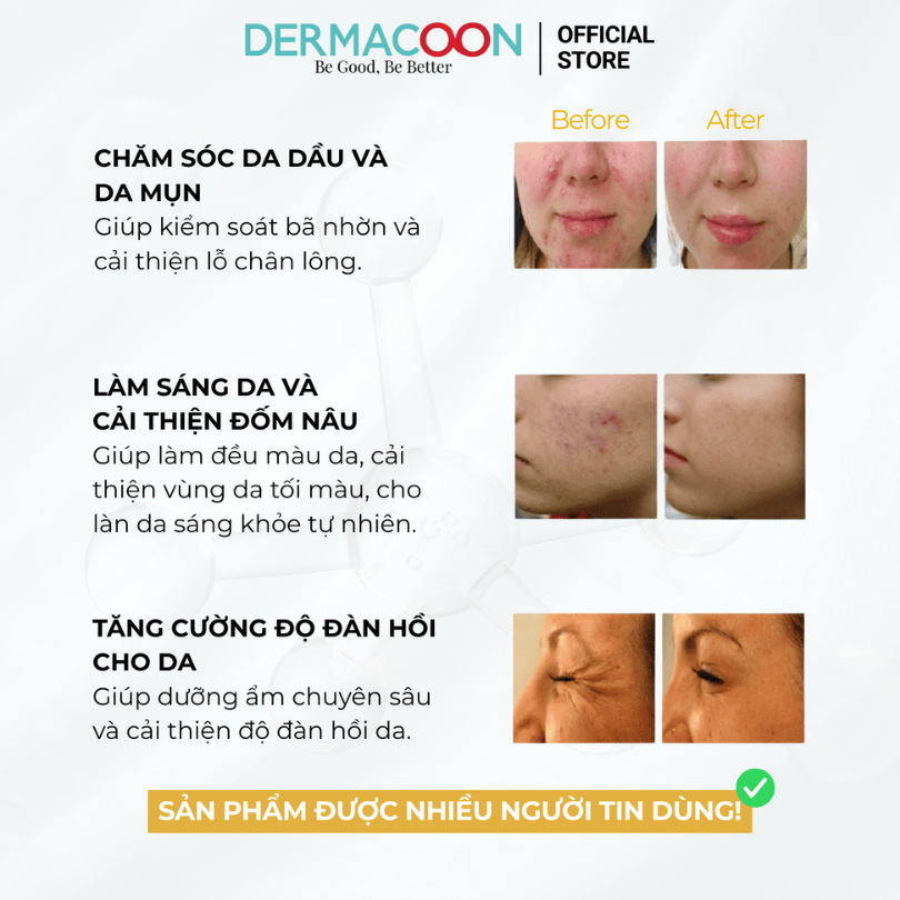 Tinh chất giúp dưỡng sáng và cải thiện độ đàn hồi da PAX MOLY Vitamin C + Collagen 5% AC Serum 50ml
