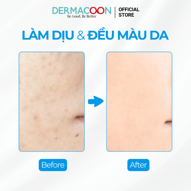 Tinh chất giúp dưỡng ẩm chuyên sâu và làm đều màu da PAX MOLY Niacinamide 5% + Hyaluronic Acid 5% AC Serum 50ml