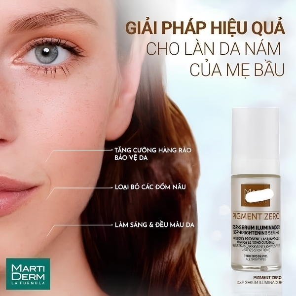 MartiDerm Pigment Zero DSP Serum Illuminator 30ml – Serum Làm Sáng Da, Hỗ Trợ Mờ Đốm Nâu Và Đều Màu Da