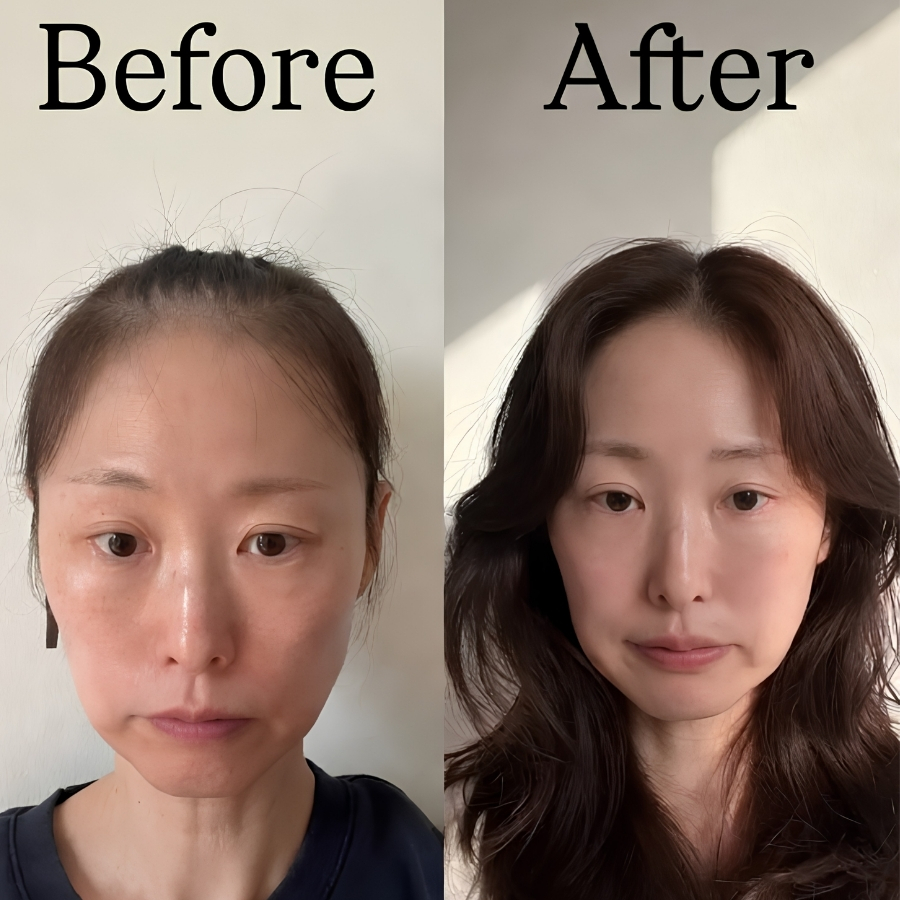 Serum Tóc The Ordinary Multi-Peptide For Hair Density 30ml – Hỗ Trợ Tóc Trông Dày Và Khỏe Hơn