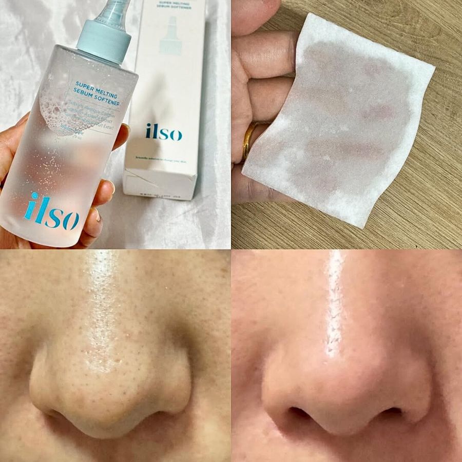 Tinh Chất Ủ Mụn Đầu Đen Ilso Super Melting Serum Softener 150ml + 40 Miếng Bông Tẩy Trang