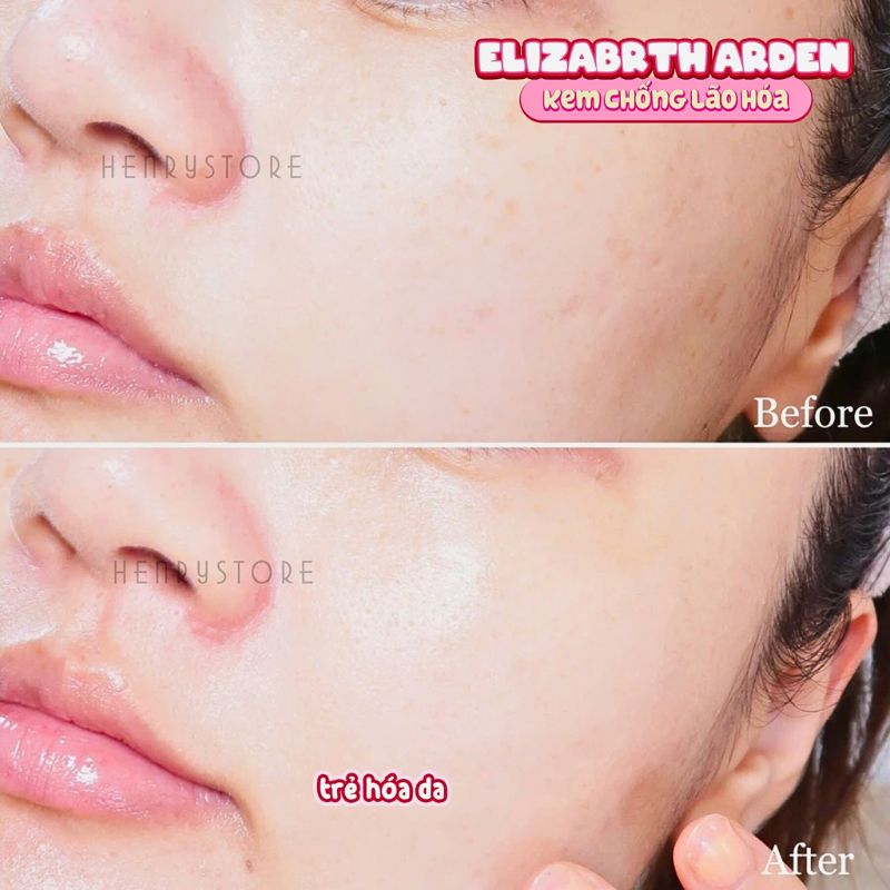 Kem Dưỡng Ẩm Trẻ Hóa Làn Da Elizabeth Arden Visible Difference Cream 75ml