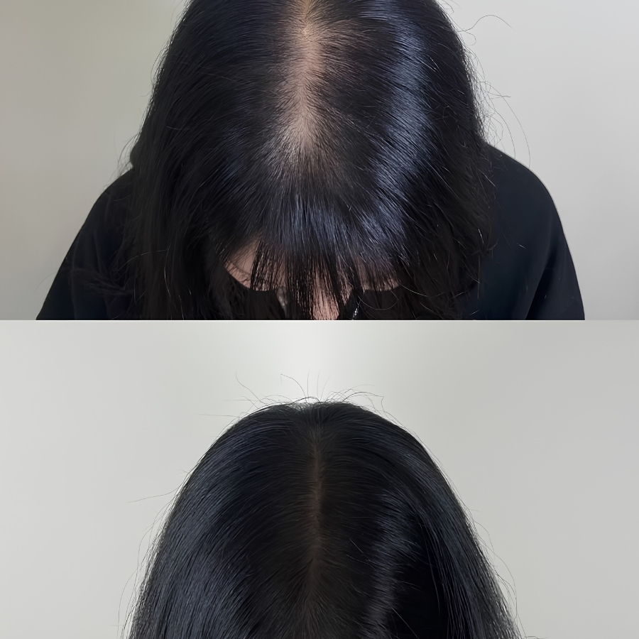 Serum Tóc The Ordinary Multi-Peptide For Hair Density 30ml – Hỗ Trợ Tóc Trông Dày Và Khỏe Hơn