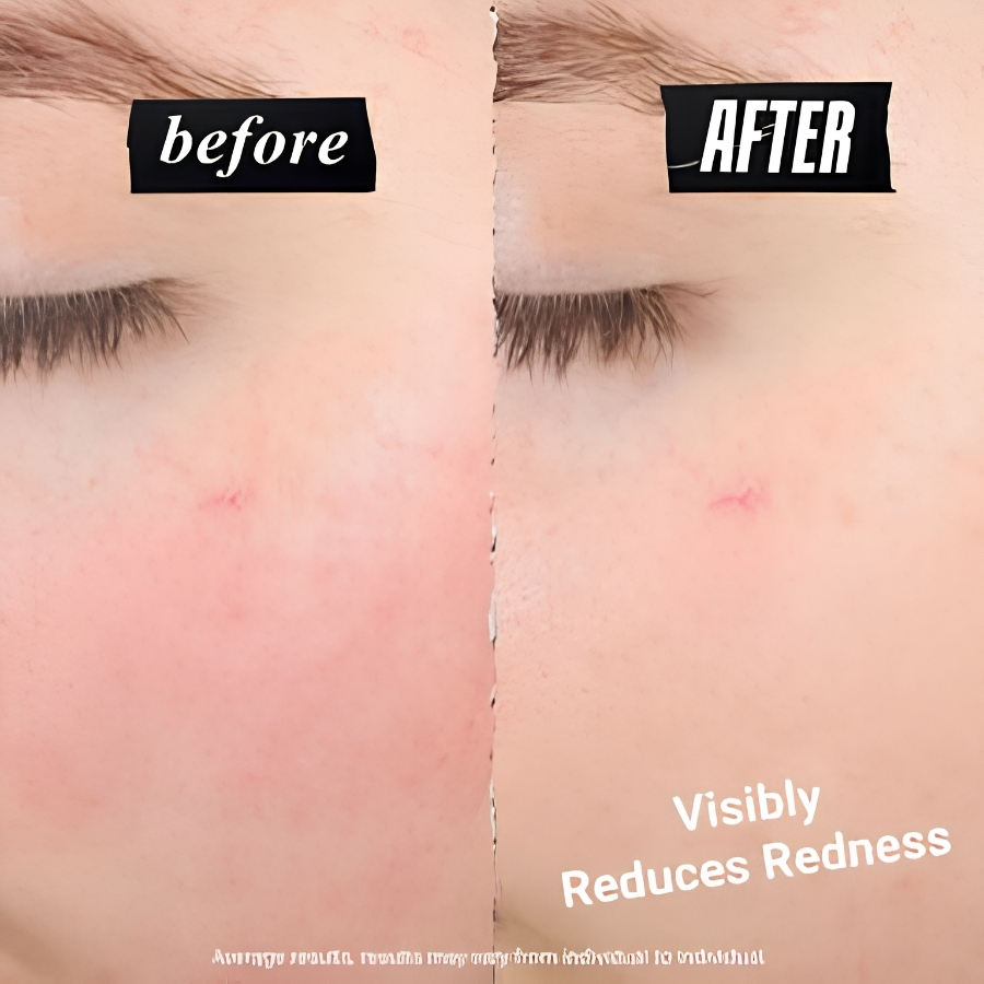 [Mini] Kem Dưỡng Kiehl’s Ultra Facial Meltdown Recovery Cream 14ml – Hỗ Trợ Làm Dịu Và Phục Hồi Da Khô Yếu